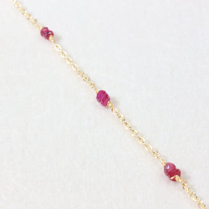 Pretty In Pink - Alet × Fuchsia Anklet